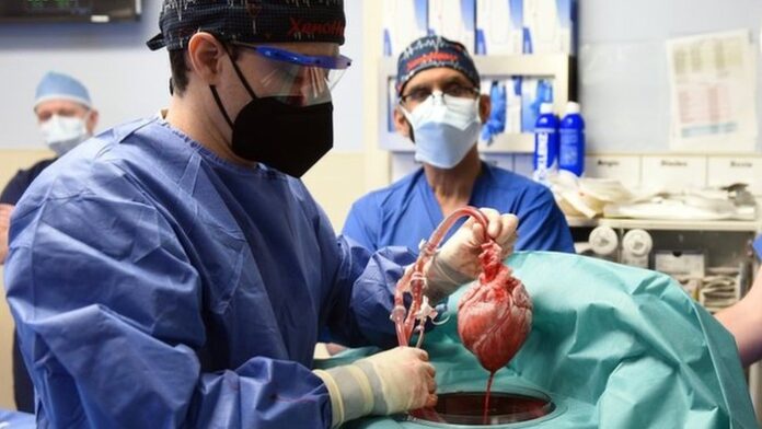 Viral ! David Bennett, Manusia Pertama di Dunia Transplantasi Jantung Babi