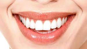 7 Cara Mencegah Karang Gigi, Agar Selalu Sehat dan Putih