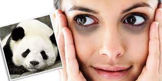 9 Cara Mudah Hilangkan Mata Panda, Dijamin Ampuh