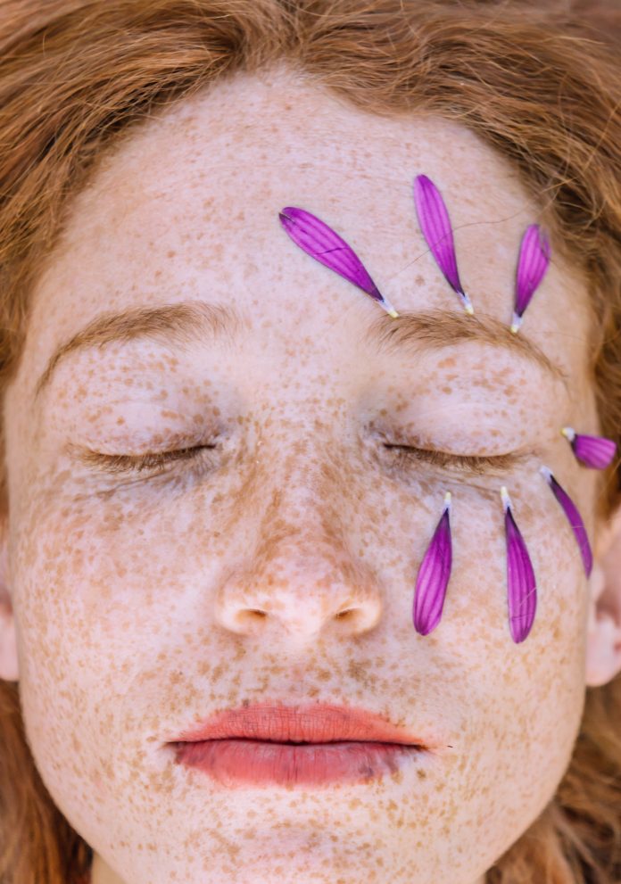 8 Tips Cara Menghilangkan Bintik Hitam di Wajah