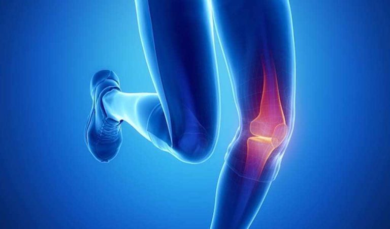 Apa Perbedaan Ligamen dan Tendon? Simak Penjelasannya!!