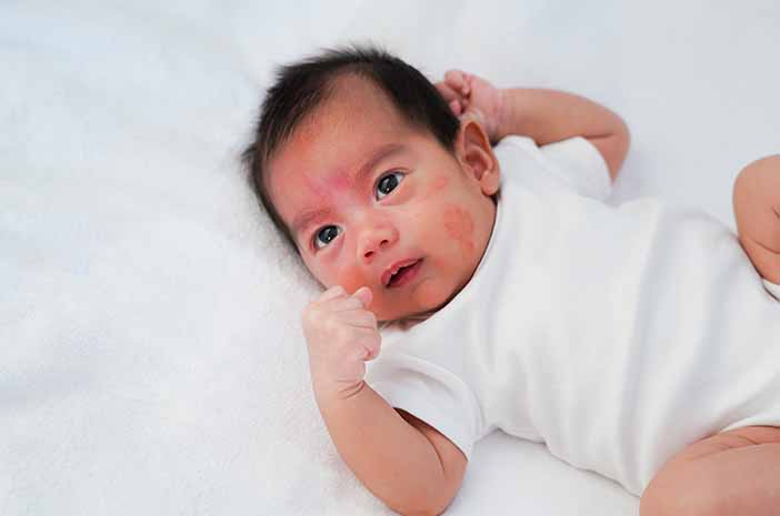 Kenali Tanda-Tanda Anak Mengalami Alergi Makanan Sejak Dini