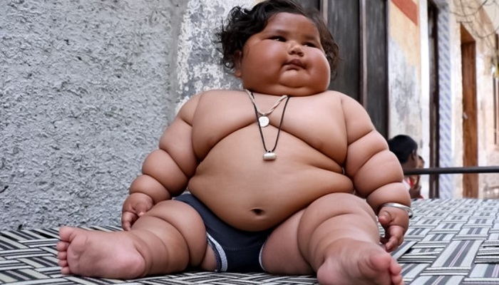 Mengatasi Obesitas pada Anak: Pola Makan dan Aktivitas Fisik yang Tepat